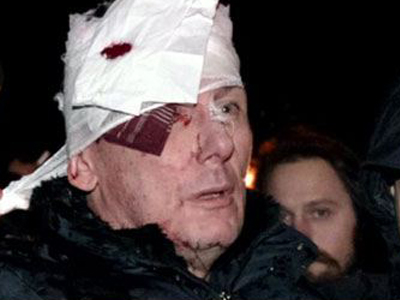 Ουκρανία: 50.000 άνθρωποι διαδήλωσαν για τον ξυλοδαρμό του Λουτσένκο