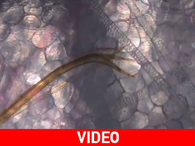 Τι κάνει το τσίμπημα του κουνουπιού μέσα στο σώμα μας