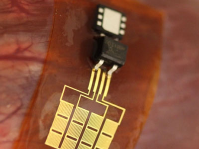 Ασύρματη φόρτιση βηματοδότη