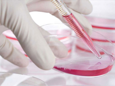 Νέο τεστ για τον καρκίνο του εντέρου