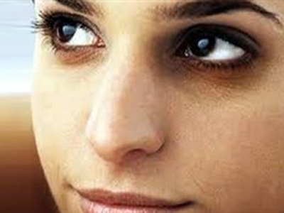 Απαλλαγείτε από τις «σακούλες» κάτω από τα μάτια