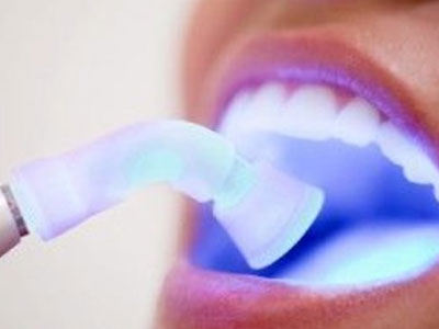 Το λέιζερ στη μάχη αναγέννησης των δοντιών