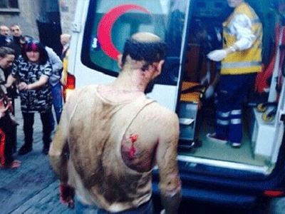 Ισχυρή  έκρηξη με τραυματίες στην Τουρκία