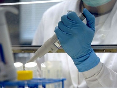 Εξετάζεται γονιδιακή θεραπεία για τον HIV