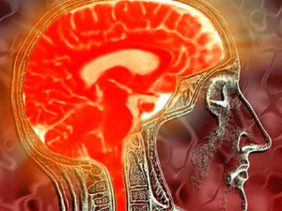 Έρευνα για την έξαρση των εγκεφαλικών στα παιδιά