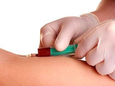 Tο DNA στο αίμα δείκτης διάγνωσης του καρκίνου του μαστού;