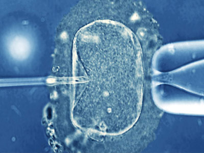 Δεν υπάρχει συσχετισμός ανάμεσα στην εξωσωματική και τον καρκίνο