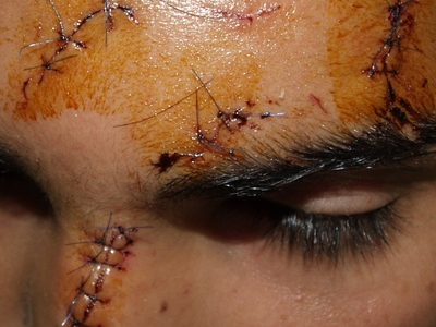 Έρευνα για την ρατσιστική επίθεση