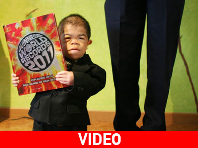 Έφηβος… με ύψος 70 εκατοστά