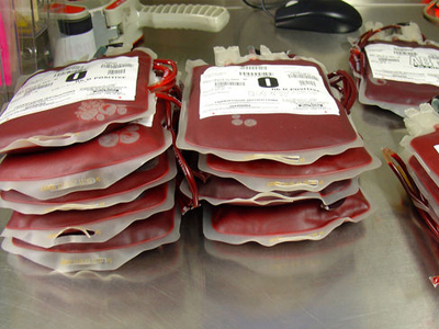 Λίγοι οι Έλληνες δότες αίματος, μυελού και ομφάλιου αίματος