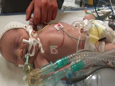 Γεννήθηκε νεκρός αλλά επανήλθε μετά από 25 λεπτά