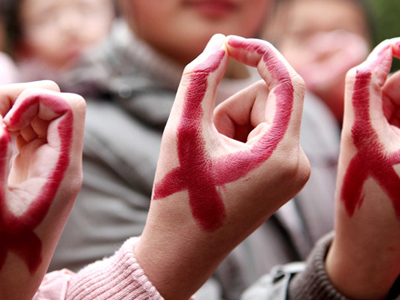 Οι ειδικοί αμφισβητούν τη «θεραπεία» του HIV