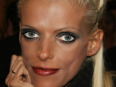 Η Νανά Καραγιάννη μιλά για τη νευρική ανορεξία