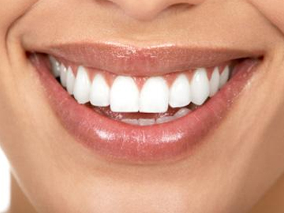 Λεύκανση δοντιών