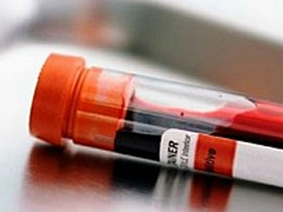 Γίνατε πλούσιος; Θα φανεί στο αίμα σας!