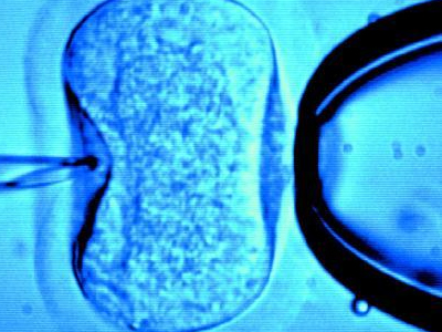 Εξωσωματική γονιμοποίηση χωρίς φαρμακευτική αγωγή – IVF