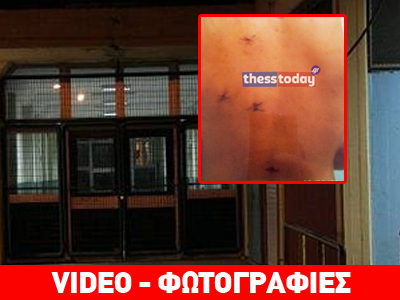 Η μαρτυρία της καθαρίστριας που δέχθηκε μαχαιριές