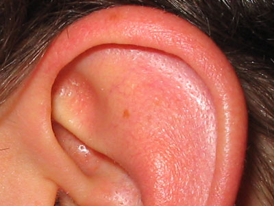 Δάγκωσαν το αυτί υπαλλήλου στο Νοσοκομείο Πύργου