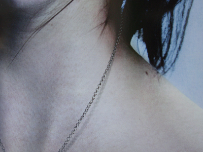 Τη χτύπησαν για να της πάρουν την αλυσίδα