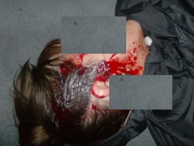 Αμερικανίδα μήνυσε την ΕΛ.ΑΣ., στο πλευρό της ο Νόαμ Τσόμσκι!