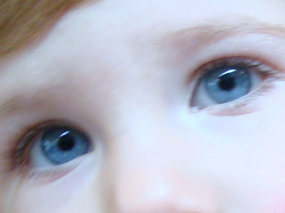 Κίνδυνος για την εμφάνιση αυτισμού, ο ίκτερος