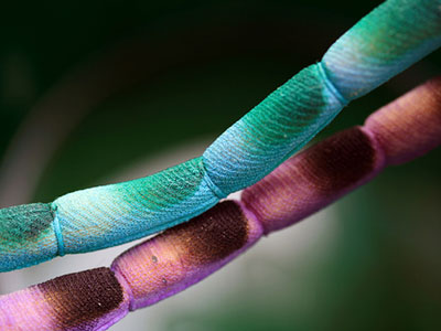 Απάτη οι κλινικές φύλαξης βλαστοκυττάρων;