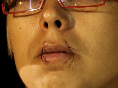 Συμπαρίστανται στους πρόσφυγες απεργούς πείνας