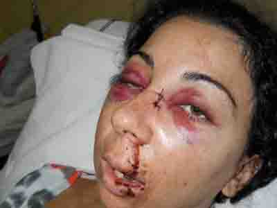 «Γίνε καλά να μου πληρώσεις το παρμπρίζ»