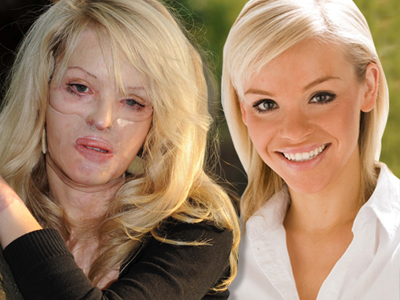 Την τιμώρησε για την ομορφιά της!