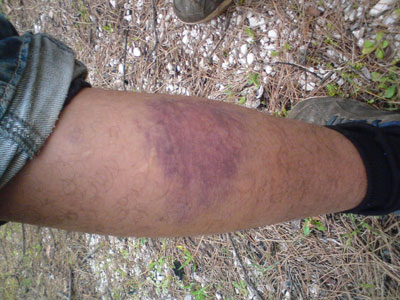 Ηγουμενίτσα: Συνεχίζεται η αστυνομική βία κατά μεταναστών