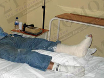 Χτύπησε άσχημα στην Κω, λόγω προχειρότητας