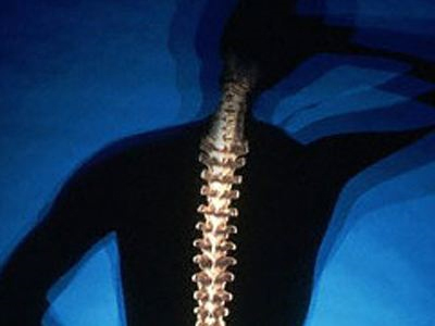 Γυναίκες τα θύματα της «σιωπηλής νόσου»