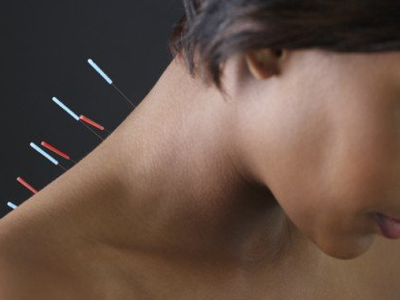 «Ένοχος» για θανάτους ο βελονισμός