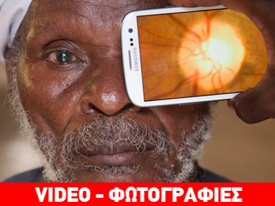 Τα κινητά τηλέφωνα στην υπηρεσία των οφθαλμολογικών εξετάσεων