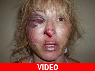 ΗΠΑ: Επειδή αρνήθηκε το αλκοτέστ