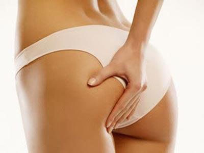 Ιοντοφόρηση: Νέα μέθοδος για την καταπολέμηση της κυτταρίτιδας