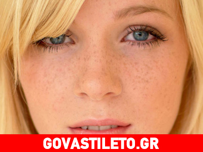 Πώς να εξαφανίσεις τις φακίδες σου