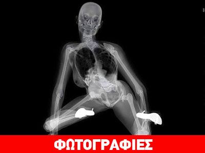 Το ημερολόγιο του σεξ με ακτίνες Χ!