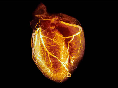 Ελπίδα για την αντιμετώπιση του καρδιακού