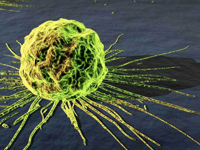 Νέα ελπίδα για την αντιμετώπιση του καρκίνου