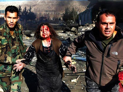 Δεκατρείς τραυματίες στη διάρκεια συναυλίας