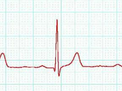 Καρδιογραφήματα με σήματα Μορς