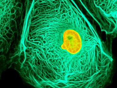 Τα κρούσματα καρκίνου αυξήθηκαν 72% από το 1960