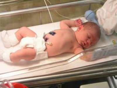 Συγκέντρωση χρημάτων για να χειρουργηθεί βρέφος Συγκέντρωση χρημάτων για να χειρουργηθεί βρέφος