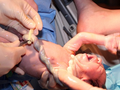 Γέννησε νεκρό το παιδί της στο σπίτι