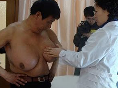 Ο άνδρας με το μεγαλύτερο στήθος στον κόσμο