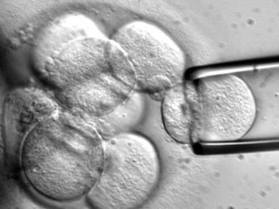 Βλαστικά κύτταρα