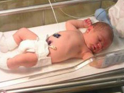 Έδωσαν ζωή σε βρέφος 7 μηνών