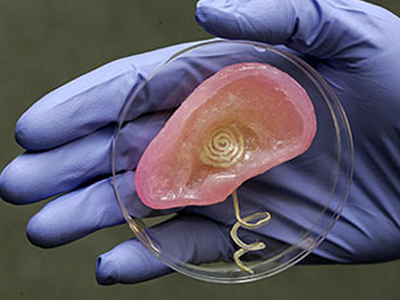 Επιστημονικό θαύμα: Τεχνητό αυτί από ιστούς