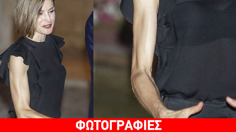 Η αποστεωμένη βασίλισσα – Νέο «κύμα» ανησυχίας για τη Letizia